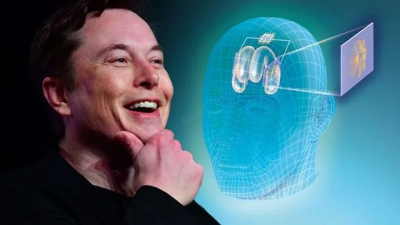 Elon Musk thotë se Neuralink ka implantuar çipin e parë të trurit te një njeri