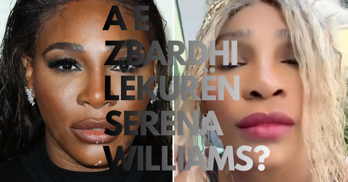 A e zbardhi lëkurën Serena Williams? – Flet burri i saj…