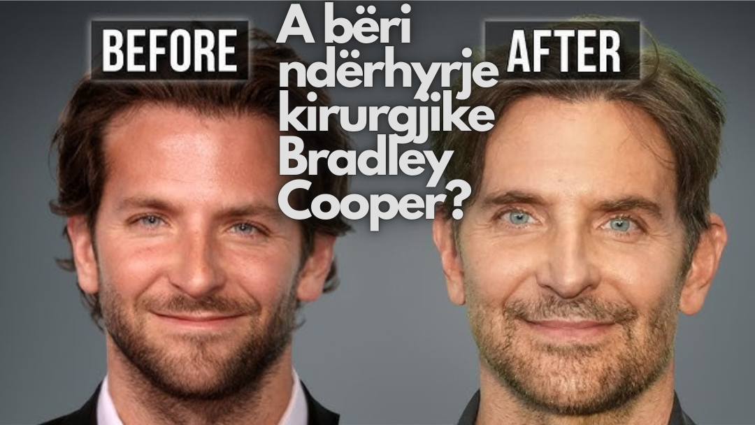 DR. TERRY DUBROW SHPËRTHEN: “MBYLLENI GOJEN PËR OPERACIONIN E BRADLEY COOPER!!!”