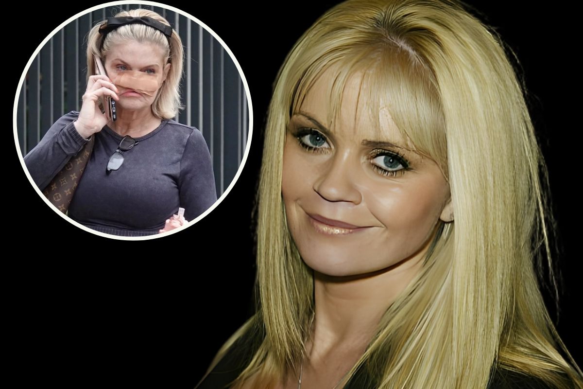 “Makthi” i Danniella Westbrook nga operacionet e rindërtmit të fytyrës pas viteve të varësisë