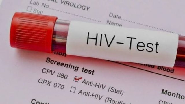 10 raste të reja me HIV në muajt e fundit në Kosovë – 2 viktima e 2 në spital, rritet testimi vullnetar