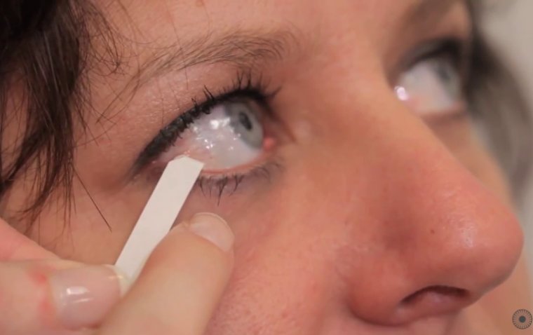 Një test i thjeshtë me lotët mund të zbulojë më herët sëmundjen e Parkinsonit