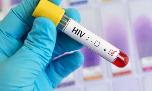 IKSHPK: Gjatë këtij viti dy të vdekur e 21 raste të reja me HIV/AIDS